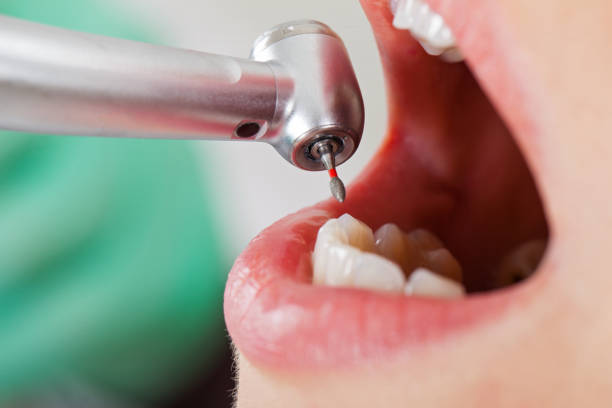Best Knocked-Out Tooth Emergency  in Elfers, FL